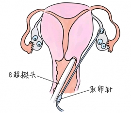 幼儿学画画，大连捐卵宝宝学画画，学画画的好处，如何学画画
